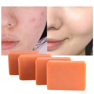 Kojic Acid Cleansing Bar Soap